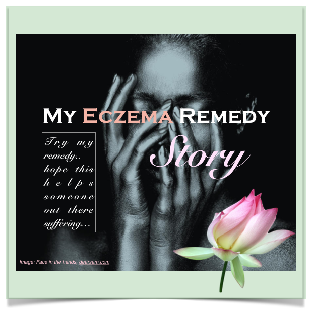 My Eczema Remedy Story